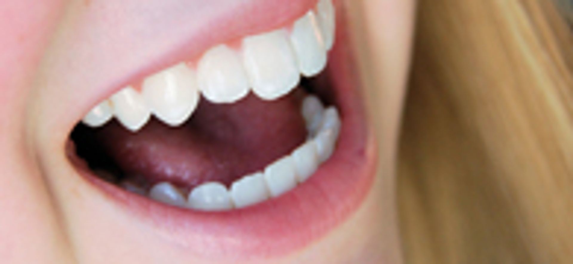 Tanden bleken niet geheel zonder - Kassa -
