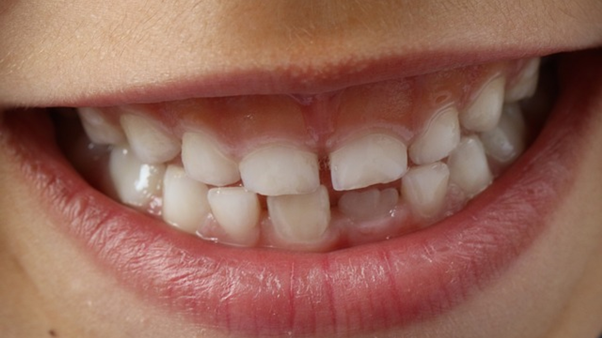 teeth-1743981_640