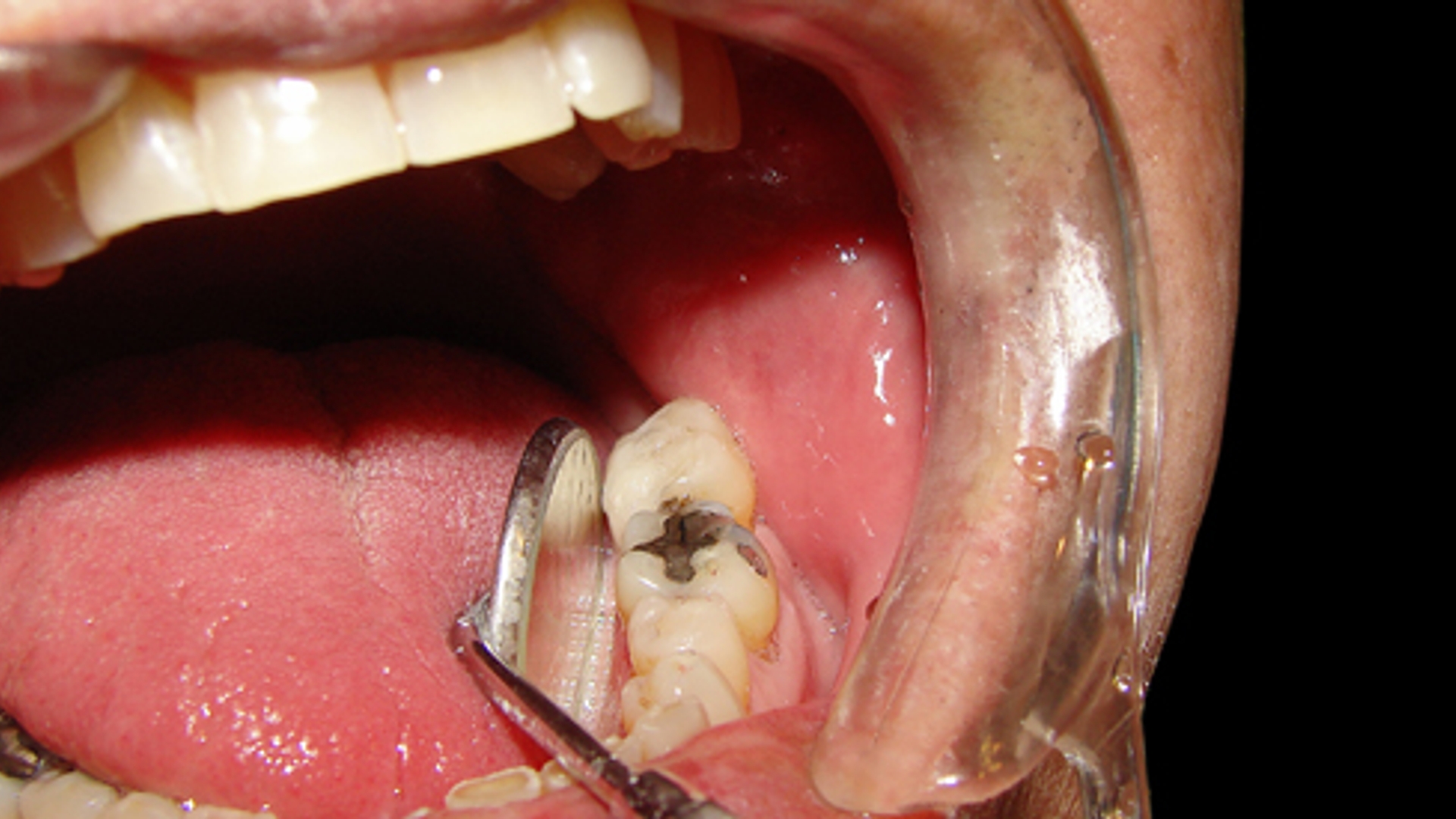 tandartsbehandeling_05.jpg