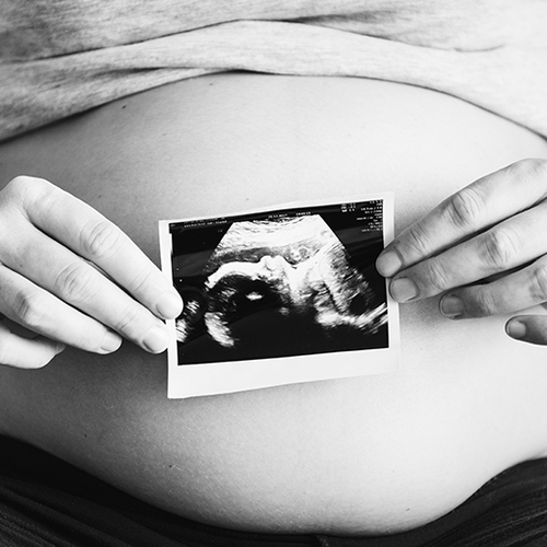 13 wekenecho beschikbaar voor alle zwangere vrouwen